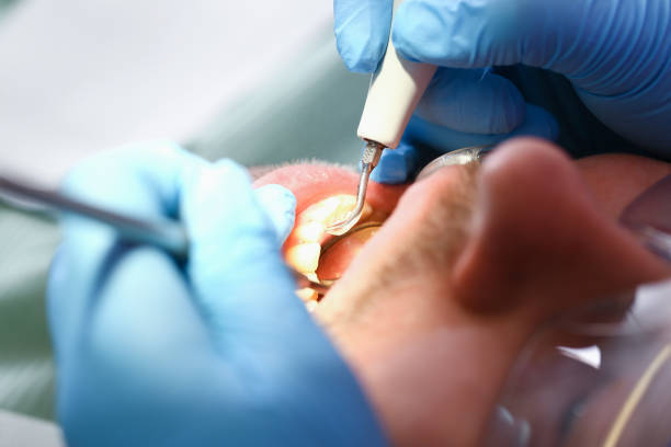 Best Walk-In Emergency Dentist in Lansing, IL
