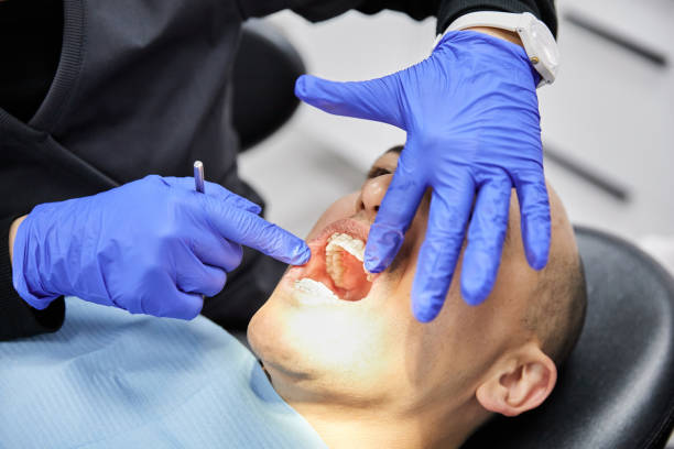 Best Emergency Dental Surgery in Lansing, IL